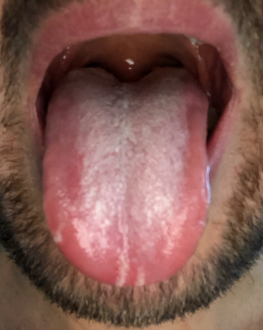 Нажмите на изображение для увеличения. 

Название:	Bildschirmfoto 2019-05-20 um 08.00.52.png 
Просмотров:	579 
Размер:	797.9 Кб 
ID:	1539